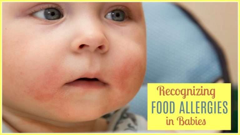 Food Allergies in Babies Who Breastfeed