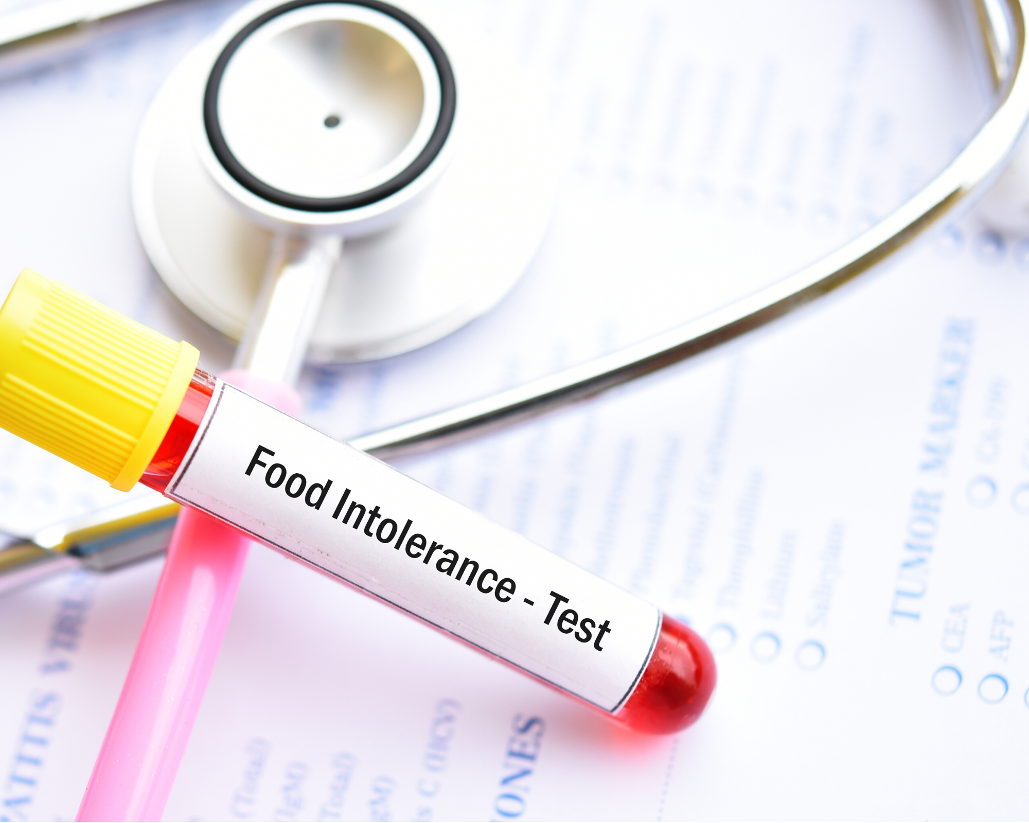 Food Allergy &  Intolerance Testing
