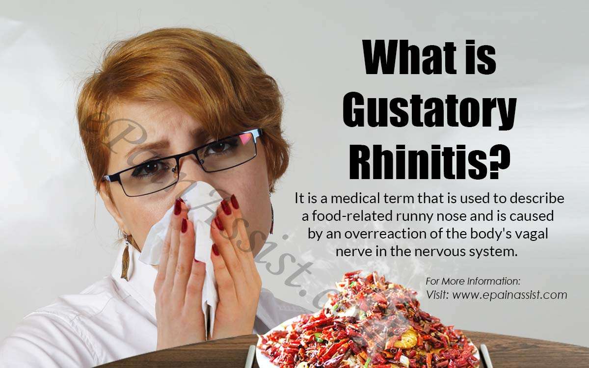 Gustatory Rhinitis: Causes, Symptoms, Treatment and Prevention of Runny ...