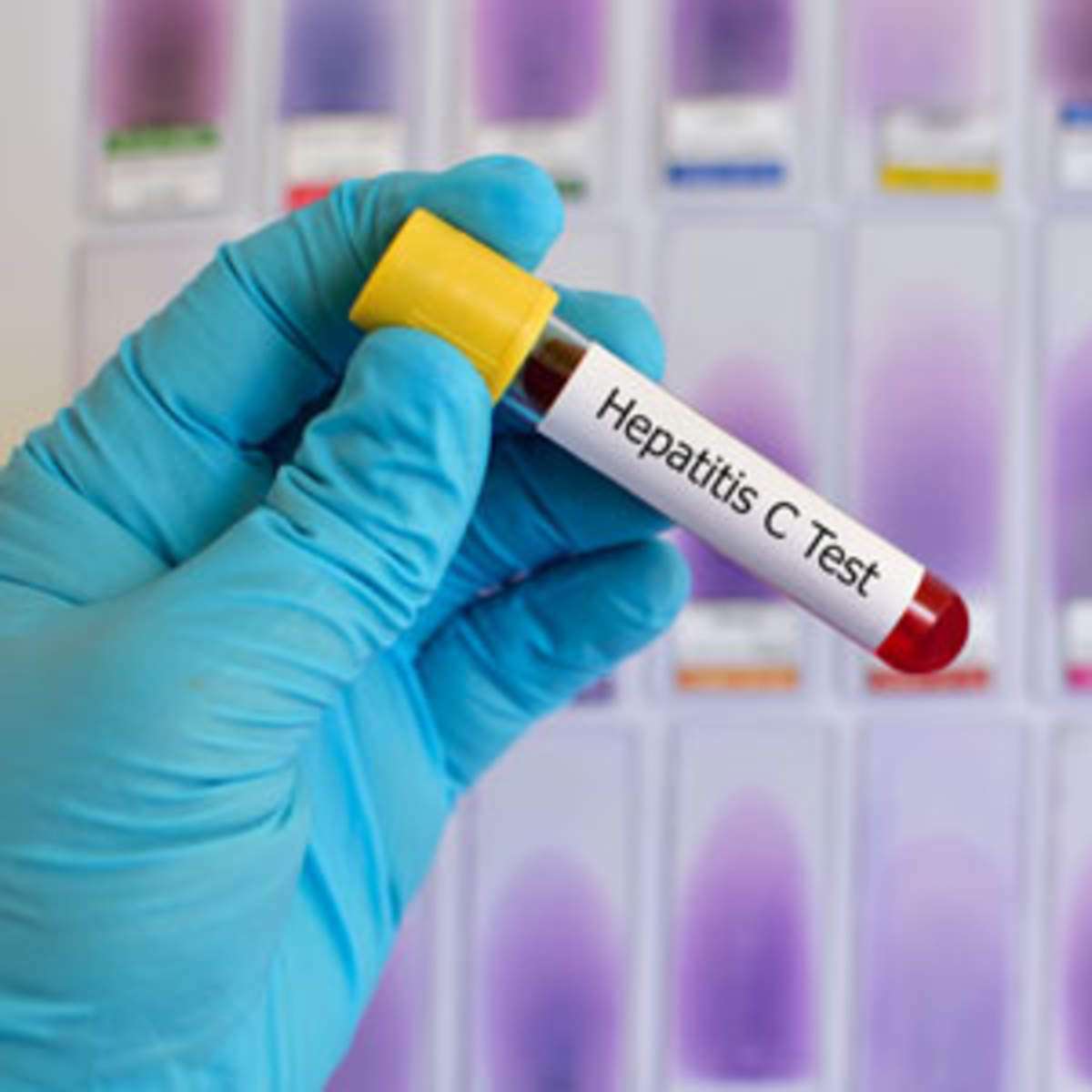 Hepatitis C Point of Care Testing: What Is Its Impact on Testing and ...
