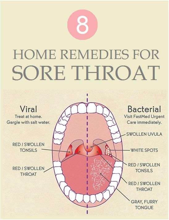 Home Herbal Remedies For Sore Throat For Cures Tonsillitis Nhs