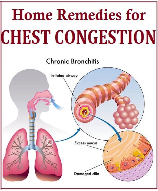 Home Remedies for Chest Congestion