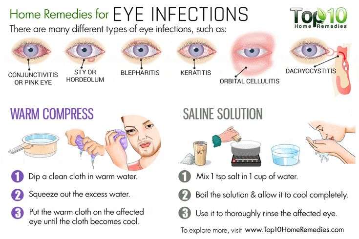 home remedies for eye infection #HomeRemediesforPinkEye ...