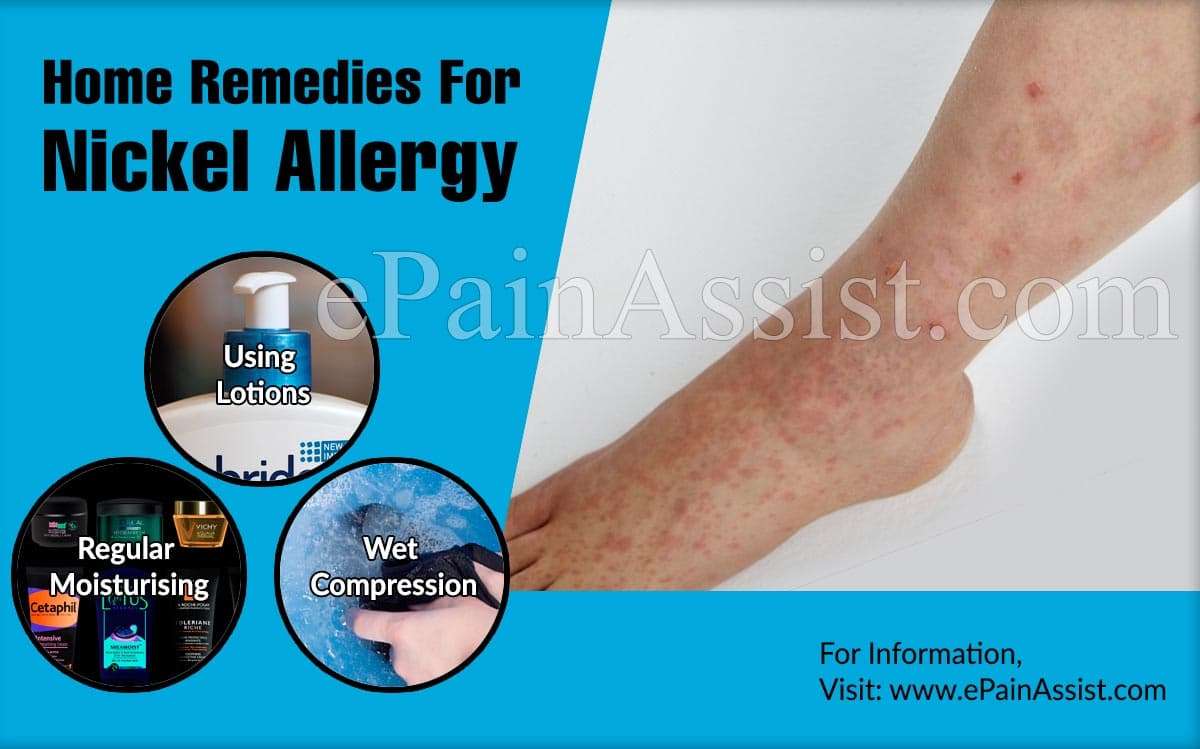 Home Remedies For Nickel Allergy