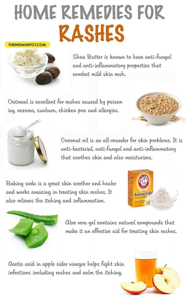 HOME REMEDIES FOR RASHES
