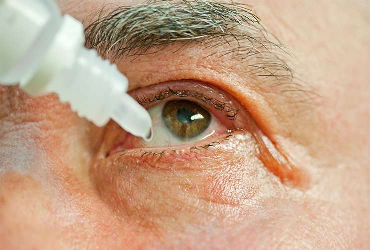 Home Remedies to Soothe Itchy Eyes