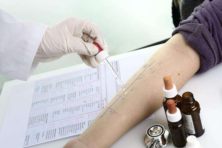 How Do Allergy Tests Work?