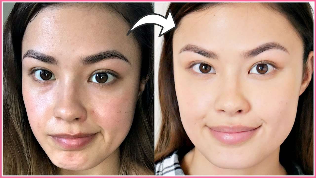 How I Manage My Breakouts (Skin Reactions)
