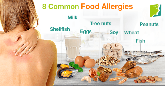 How long does a food allergy last in your system?