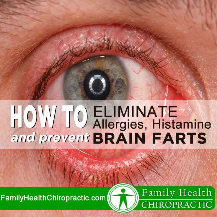 How to Eliminate Allergies, Histamine &  Prevent Brain ...