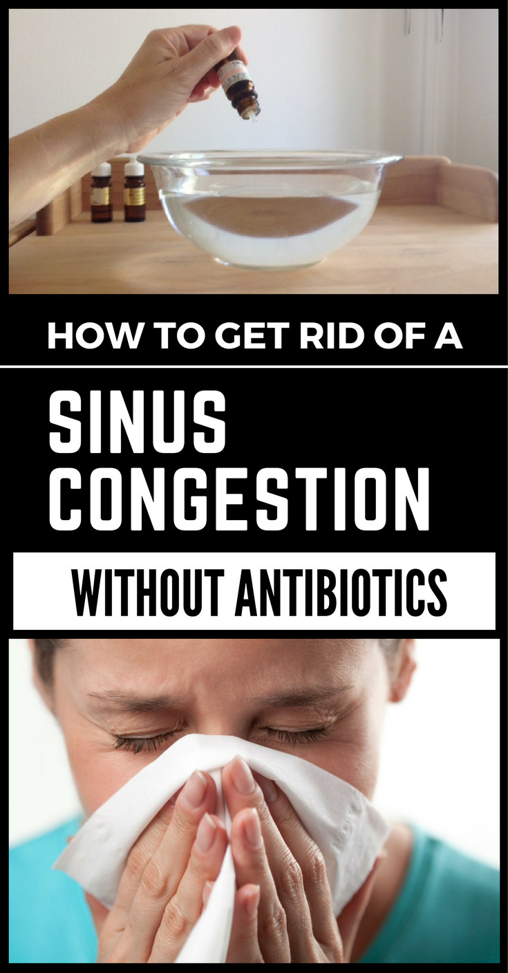 How to get rid of a Sinus Congestion without Antibiotics