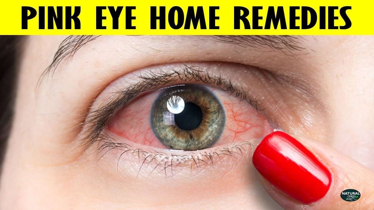 How to Get Rid of Pink Eye