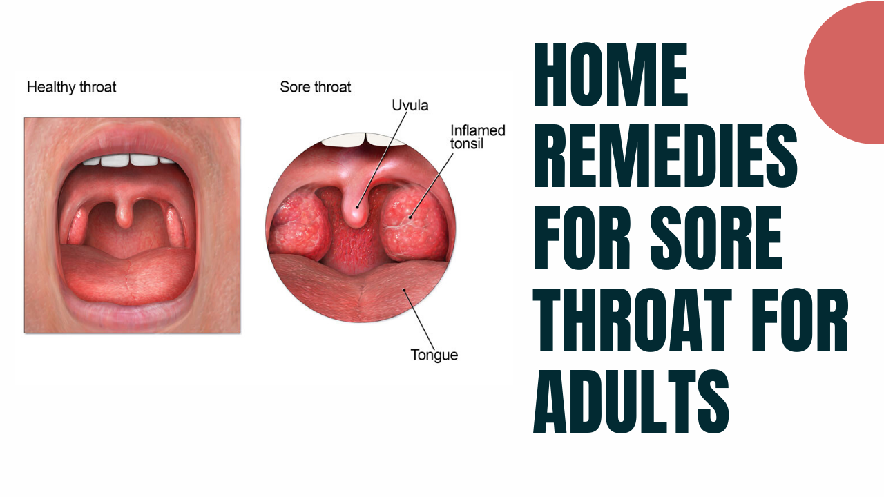 How To Get Rid Of Sore Throat Caused By Allergies â Mednifico.com