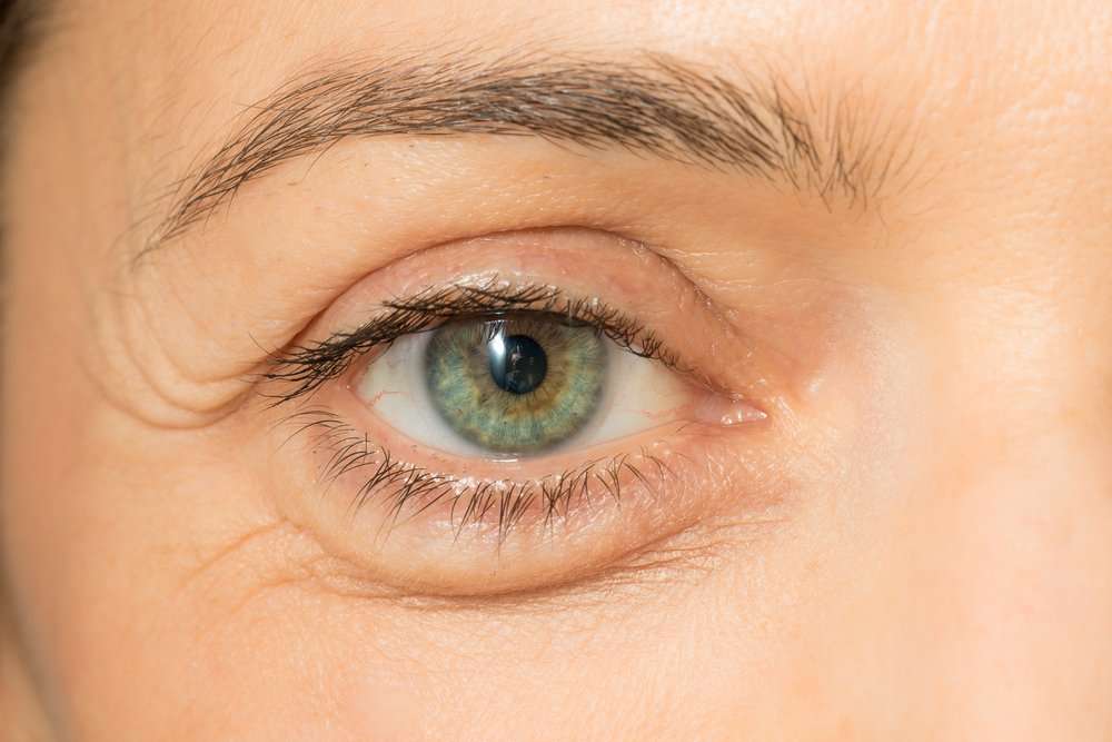 How to get rid of triple eyelids without surgery ...