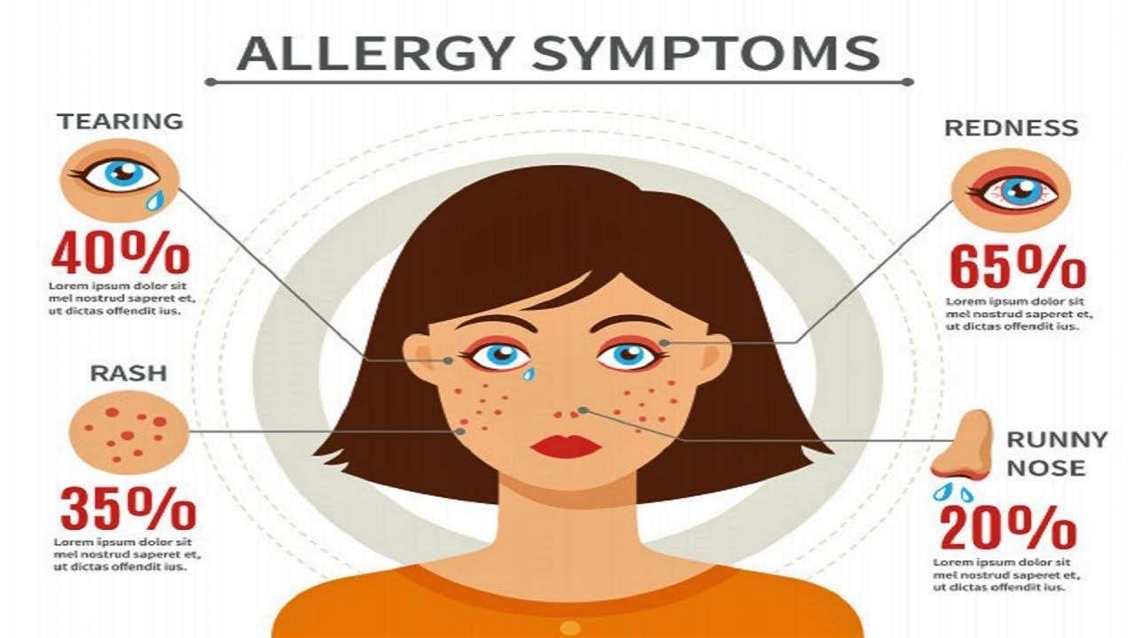 How To Know If I Have Food Allergy