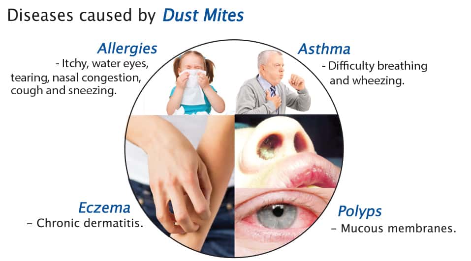 How To Know If You Have Dust Mites (Dust Mites Pictures)