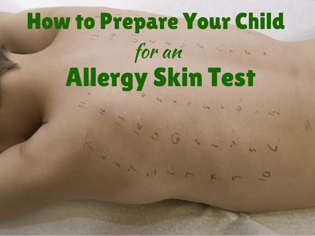 How to Prepare Your Child for an Allergy Skin Test
