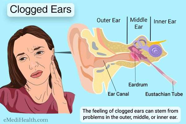 How to Safely Unclog Your Ears