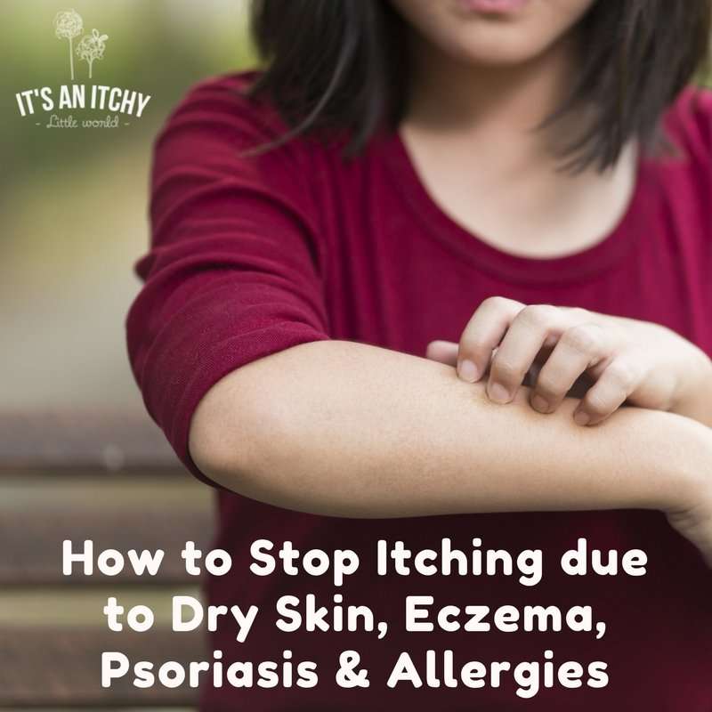 How to Stop Itching due to Dry Skin, Eczema, Psoriasis ...
