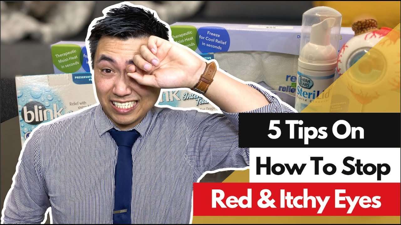 How To Stop RED &  ITCHY Eyes