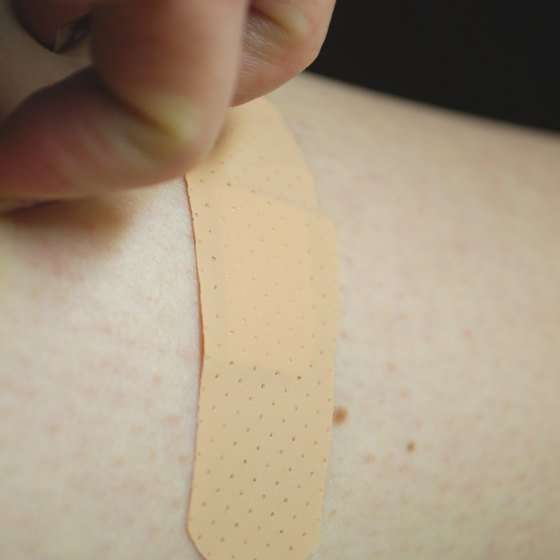 How to Treat a Latex Adhesive Allergic Skin Rash