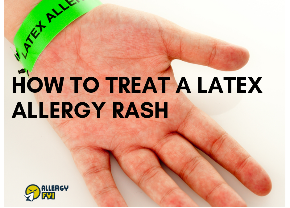 How To Treat A Latex Allergy Rash: Ultimate Guide ...
