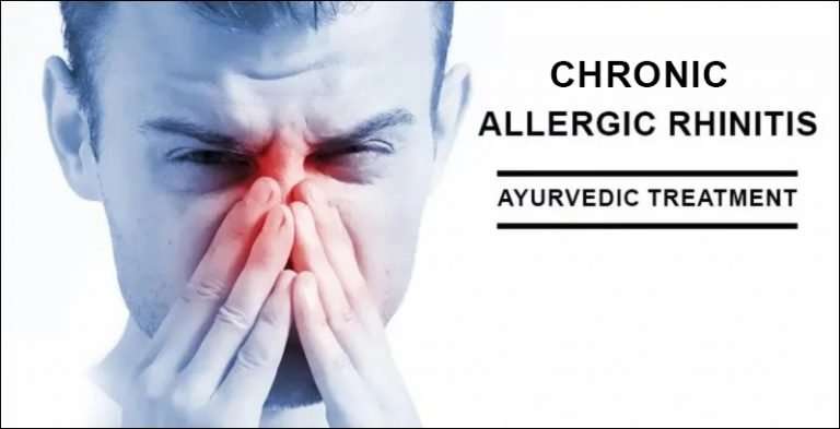 How to Treat Chronic Allergic Rhinitis in Ayurveda?