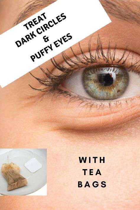 How to use tea bags to get rid of dark circles &  puffy ...