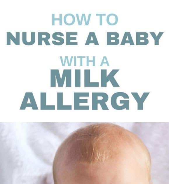 Introducing Dairy To Milk Allergy Infant / Signs Your Baby Has A Milk ...