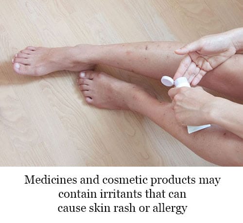 Is this justice....?: How to Get Rid of Itchy Skin Rashes or Allergies ...