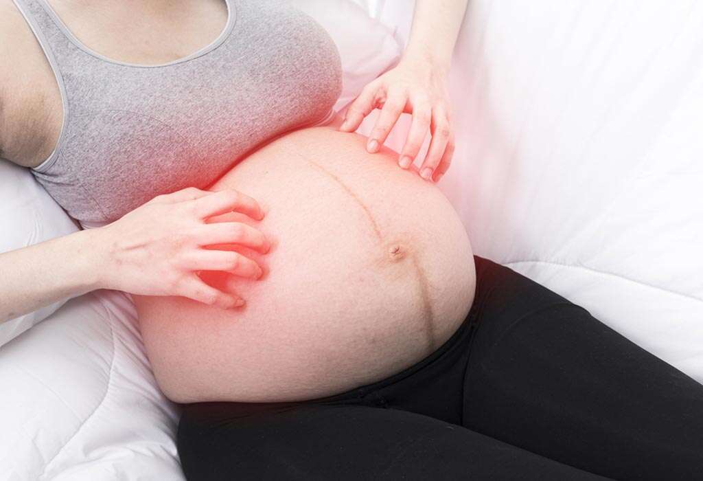 Itching All Over the Body, Can Pregnant Women Take Allergy ...