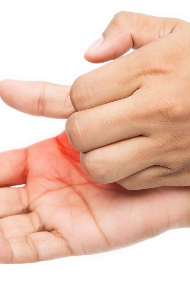 Itchy palms: 6 causes, treatment, and prevention
