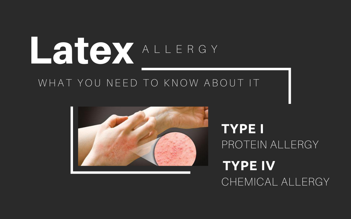 Latex allergy related to gloves
