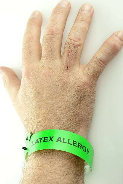 Latex Allergy Stock Photos, Pictures &  Royalty