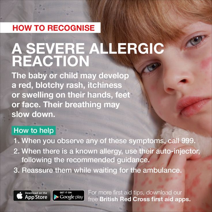 Learn how to help a baby or child having a severe allergic reaction. # ...