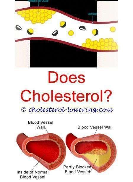 #lowcholesterolrecipes can high cholesterol levels effect ...