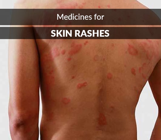 Medicine For Skin Allergy Itching : Ampicillin Or Amoxicillin Rash ...