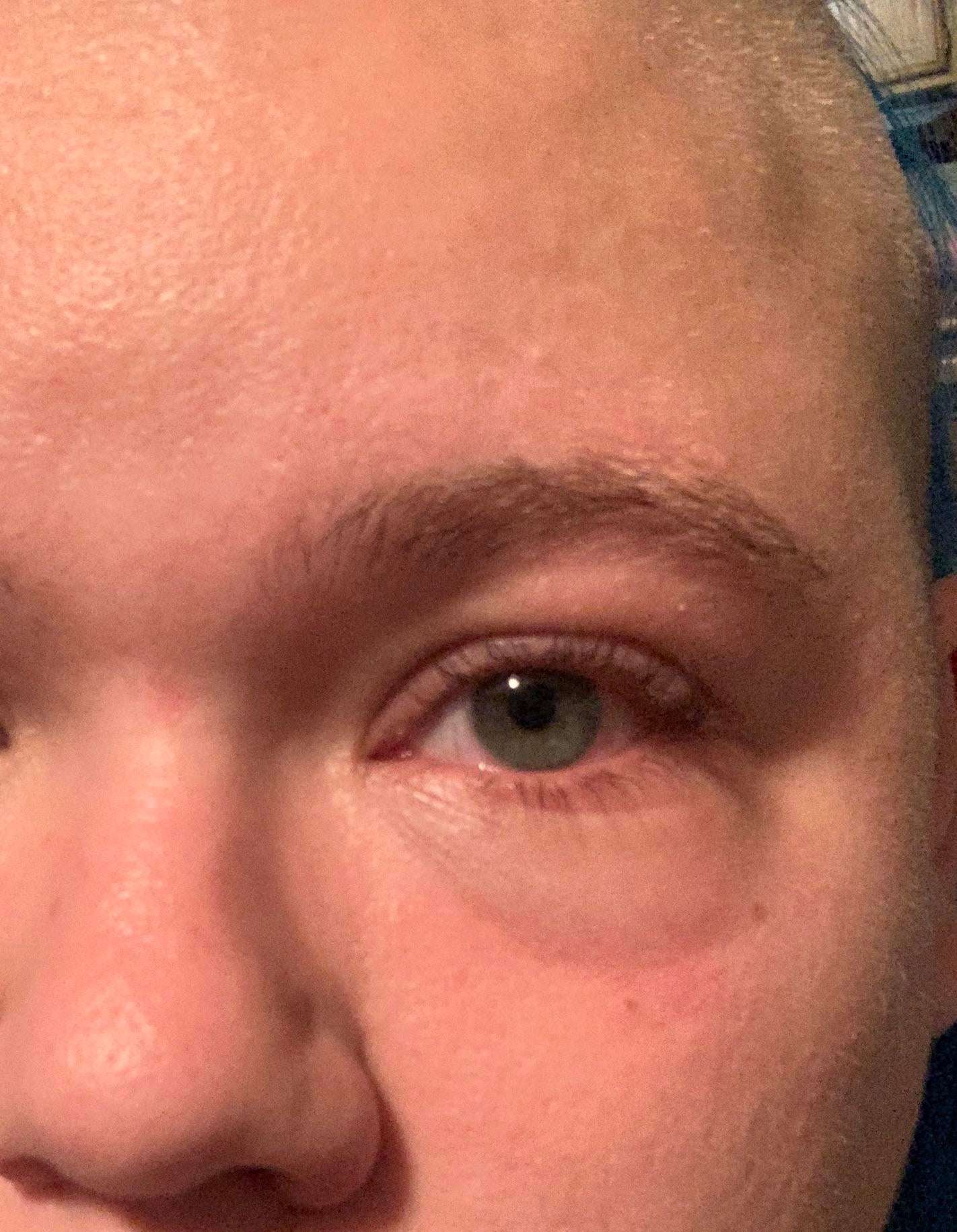 My eye has been swelling up for hours and I dont know why ...