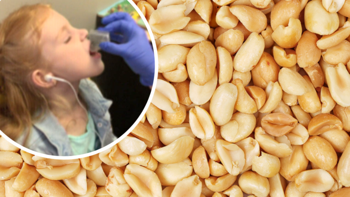 Peanut allergy breakthrough treatment saved a Brisbane girl