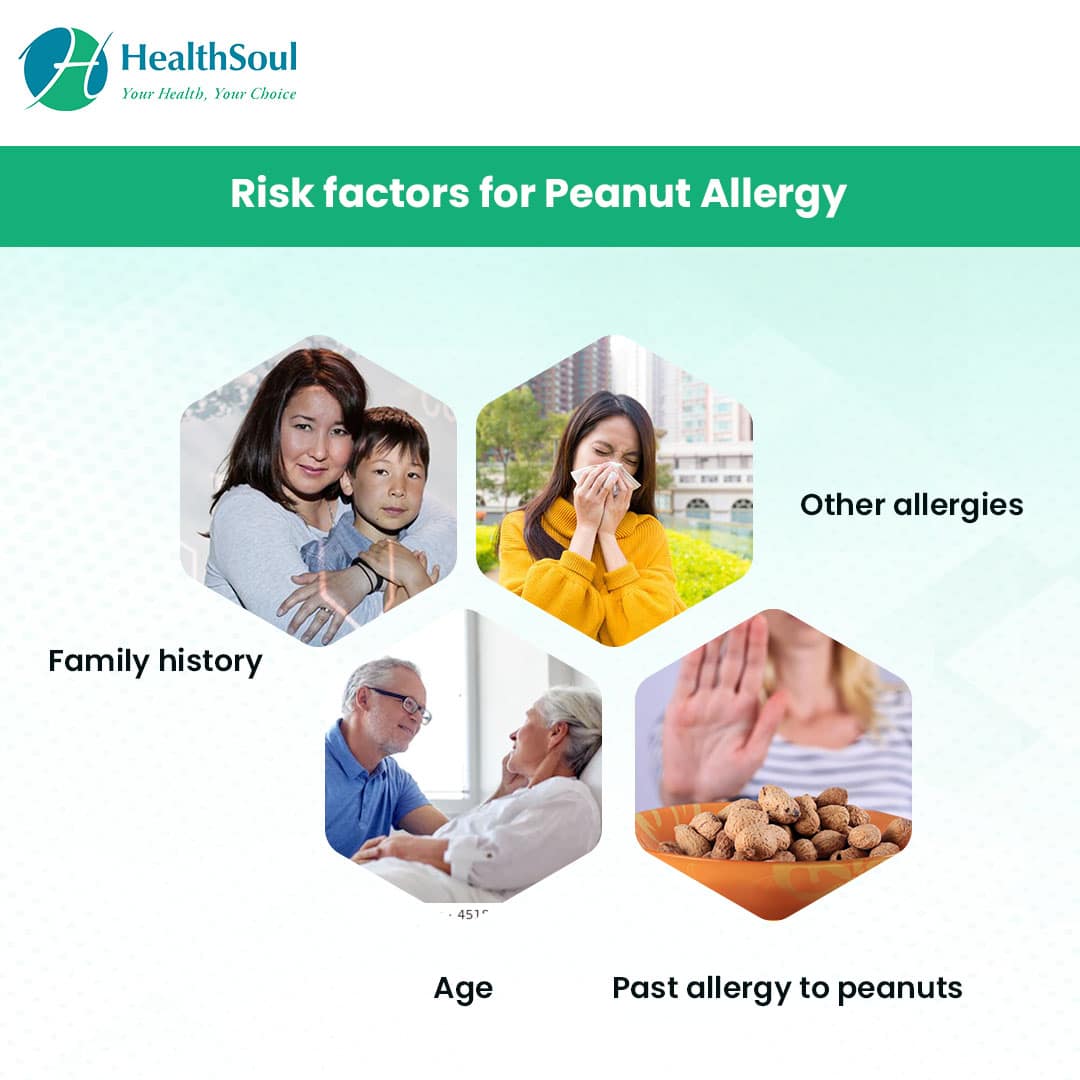 Peanut Allergy: Symptoms, Causes and Management  Healthsoul