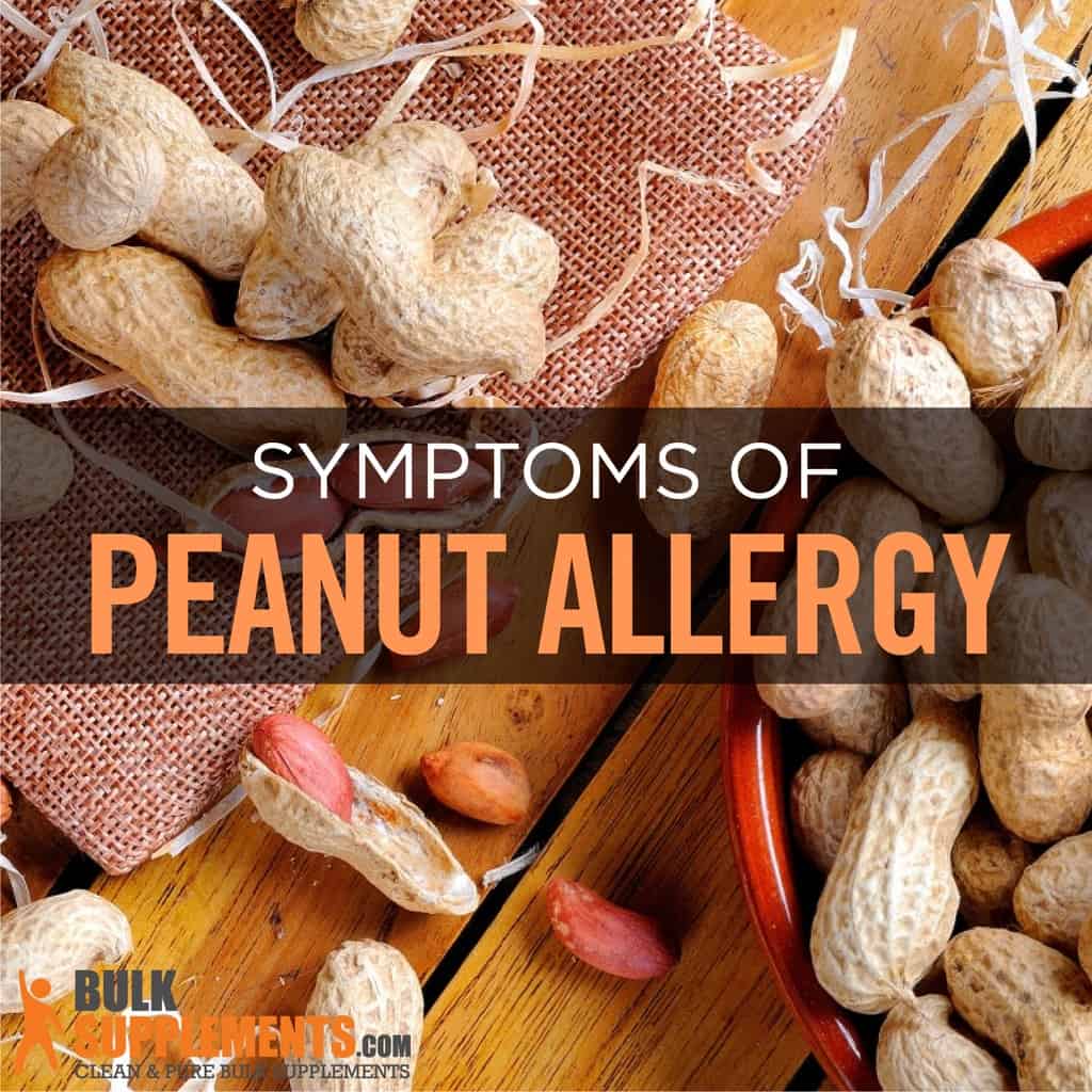 Peanut Allergy: Symptoms, Causes &  Treatment