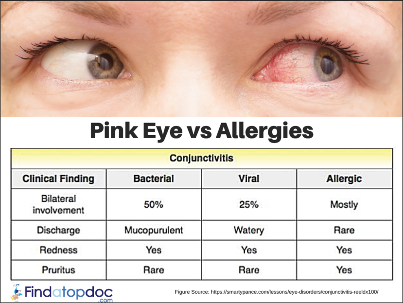 Pink Eye (Conjunctivitis): Symptoms, Causes, Treatment ...