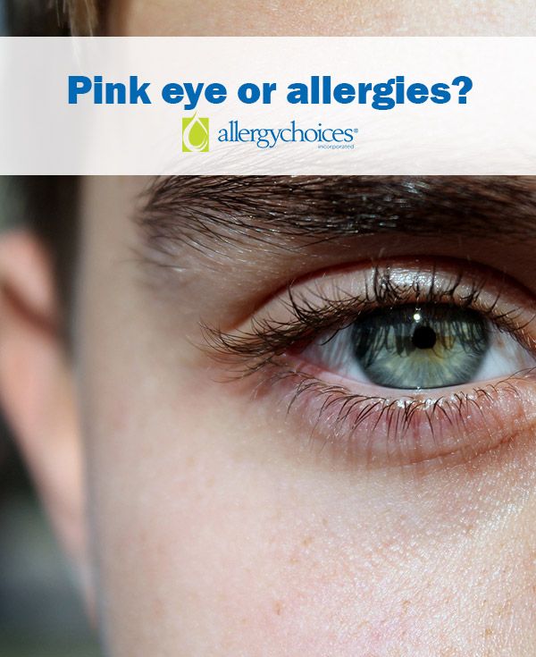 Pink eye or allergies?