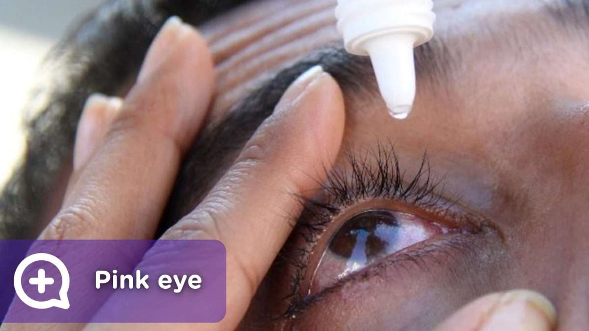Pink eye, this is how it is spread and cured