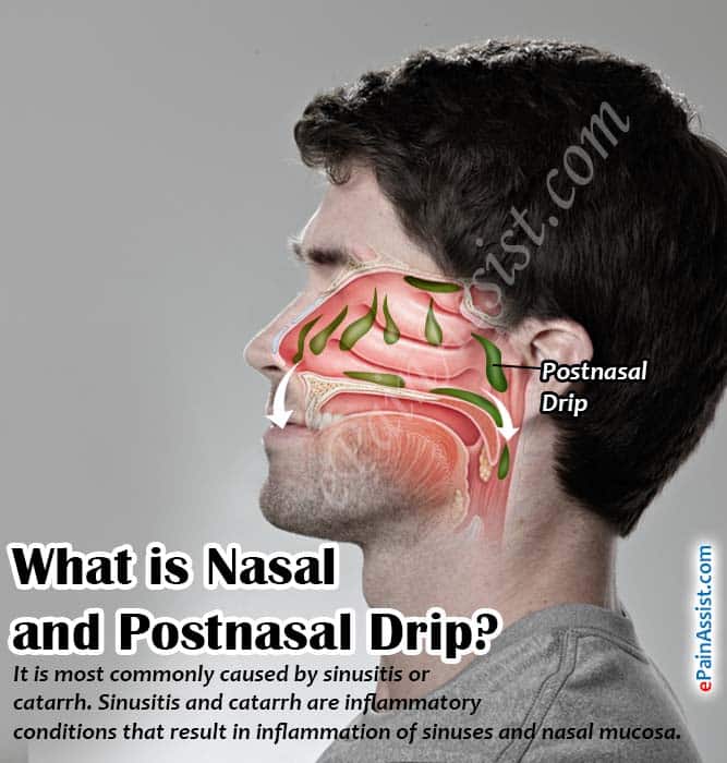 Post Nasal Drip Food Intolerance
