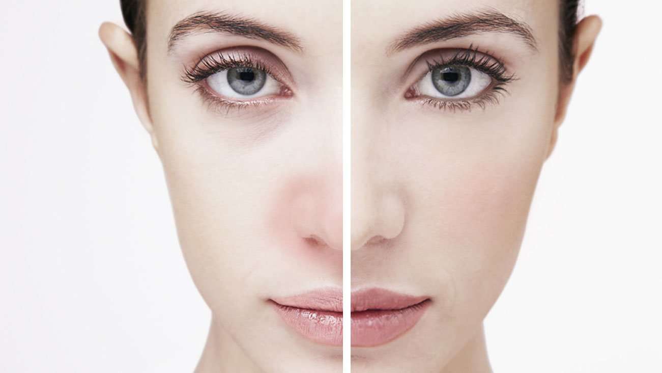 pulsatedesign: How To Treat Cosmetic Allergy On Face