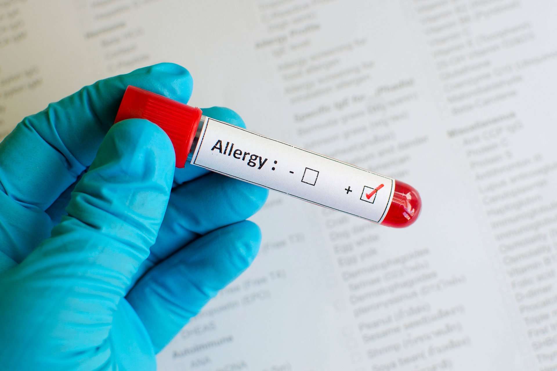 Rast Food Allergy Test  Lab 24