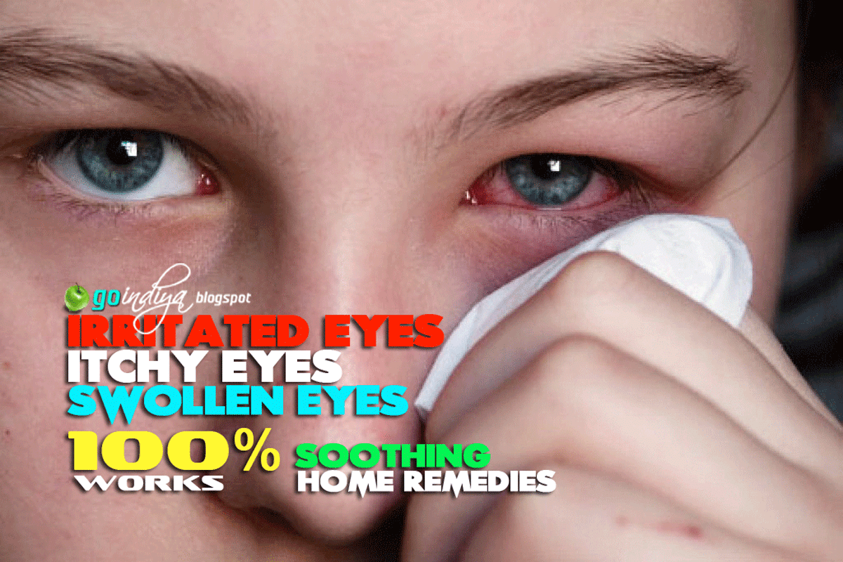 Red, itchy eyes? 25 Home Remedies for Soothing Itchy, Swollen ...