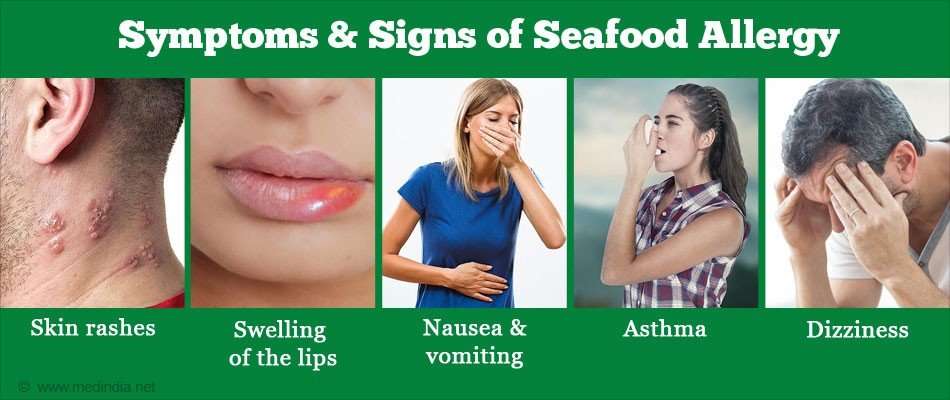 Seafood allergies and Seaweed
