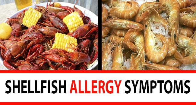 Shellfish Allergy Symptoms &  Diagnosis